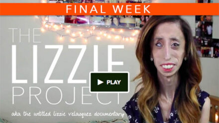 Lizzie Velasquez wurde wegen ihres Aussehens oft gehänselt. Nun will sie einen Film gegen Mobbing produzieren.