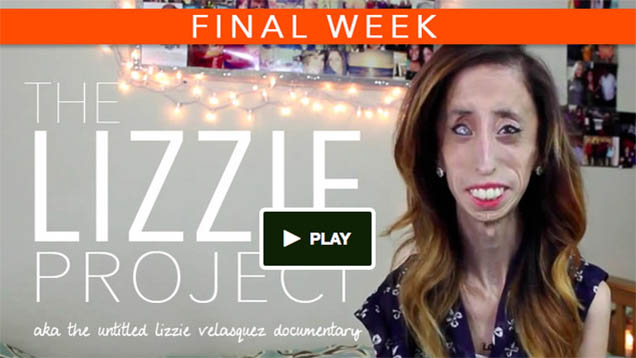 Lizzie Velasquez wurde wegen ihres Aussehens oft gehänselt. Nun will sie einen Film gegen Mobbing produzieren.