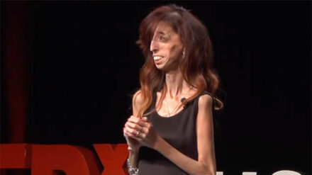 Lizzie Velasquez hat ein neues Buch geschrieben, in dem sie über ihre Krankheit und ihre Lebensziele spricht