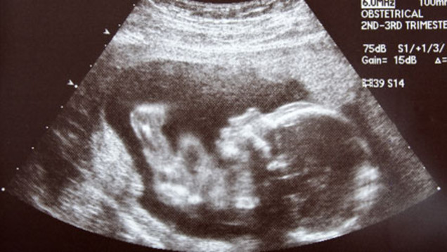 Der Ethikrat hat über die Embryonen-Adoption beraten und empfiehlt nun, Gesetzeslücken zu schließen