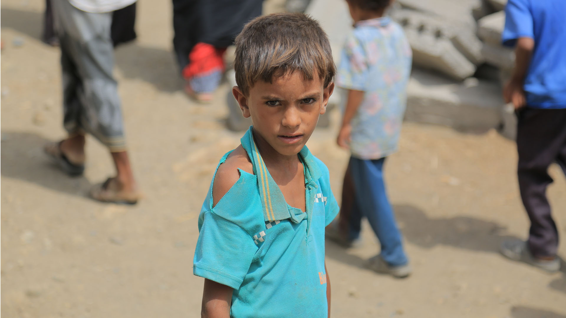 Kinder im Jemen leiden häufig an Mangelernährung
