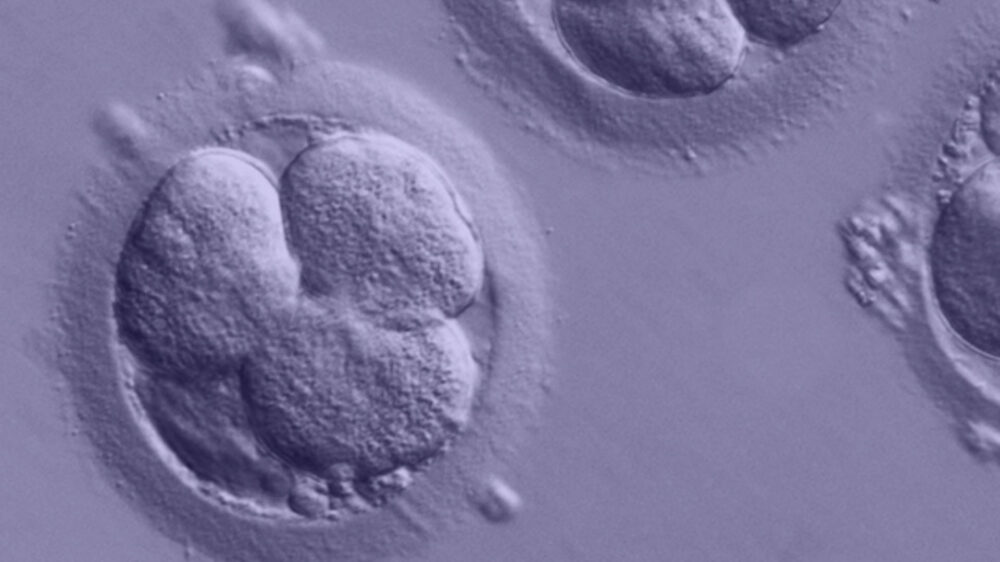 Embryo im Zellstadium (Symbolbild)
