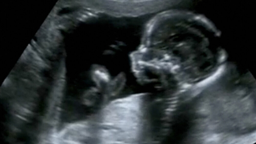 Schwangerschaftsabbrüche sind in New York jetzt legal. Ein Gesetz wurde am Dienstag verabschiedet.