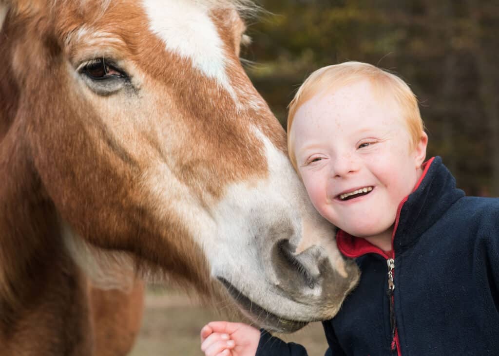 Kind mit Down-Syndrom